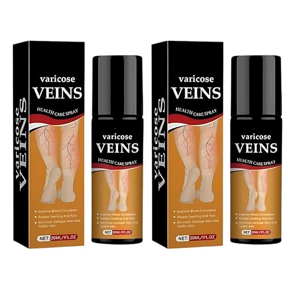 Varicose Veins